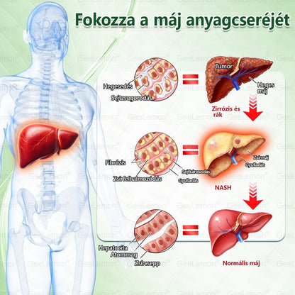 Ajánlott a Semmelweis Kórház által · 👩‍⚕️BENU hivatalos üzlet| 🎁 𝐆𝐞𝑒𝐿𝑒𝐦𝐨𝐧® Glumasetide 8 az 1-ben Karcsú és Egészséges Nano Mikrotűs Tapasz 🇭🇺