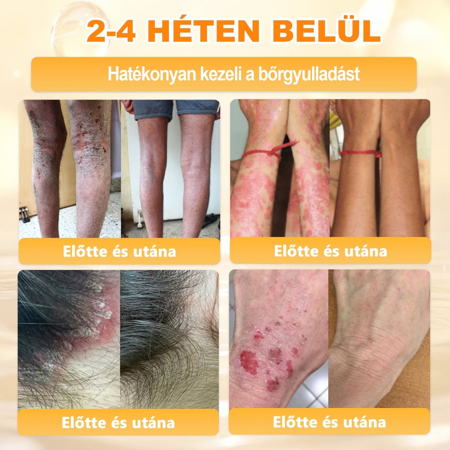 Ajánlott a Semmelweis Kórház által · BENU hivatalos üzlet✨✨ 𝖠𝖯𝖪𝖠𝖯𝖪® méhméreges bőrmegújító krém