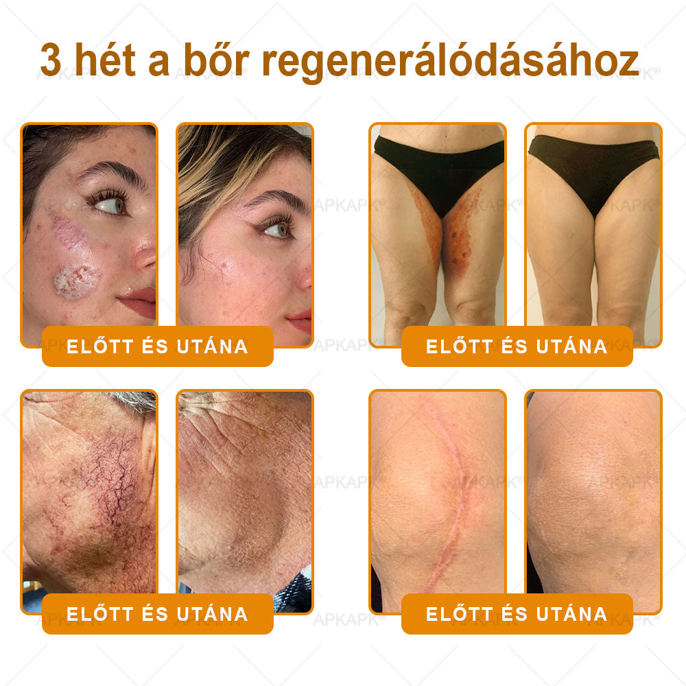 Ajánlott a Semmelweis Kórház által · BENU hivatalos üzlet✨✨ 𝖠𝖯𝖪𝖠𝖯𝖪® méhméreges bőrmegújító krém