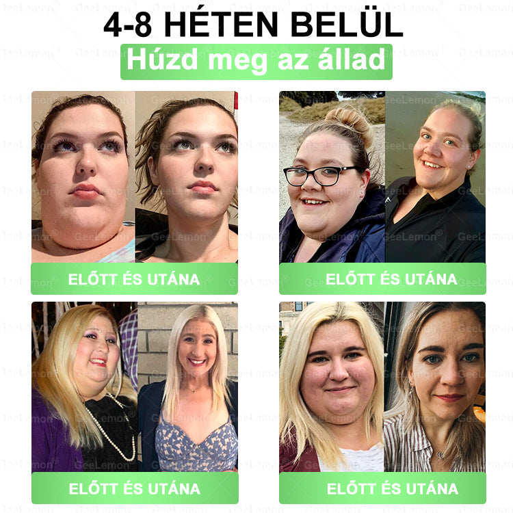 Ajánlott a Semmelweis Kórház által · 👩‍⚕️BENU hivatalos üzlet| 🎁 𝐆𝐞𝑒𝐿𝑒𝐦𝐨𝐧® Glumasetide 8 az 1-ben Karcsú és Egészséges Nano Mikrotűs Tapasz 🇭🇺