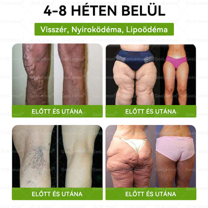 Ajánlott a Semmelweis Kórház által · 👩‍⚕️BENU hivatalos üzlet| 🎁 𝐆𝐞𝑒𝐿𝑒𝐦𝐨𝐧® Glumasetide 8 az 1-ben Karcsú és Egészséges Nano Mikrotűs Tapasz 🇭🇺