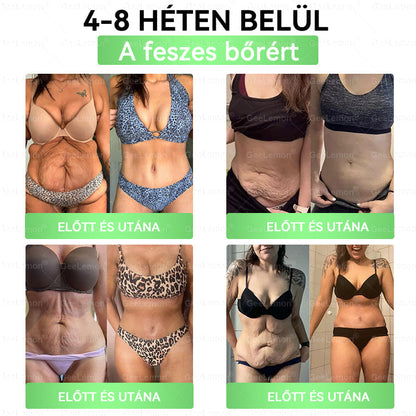 Ajánlott a Semmelweis Kórház által · 👩‍⚕️BENU hivatalos üzlet| 🎁 𝐆𝐞𝑒𝐿𝑒𝐦𝐨𝐧® Glumasetide 8 az 1-ben Karcsú és Egészséges Nano Mikrotűs Tapasz 🇭🇺